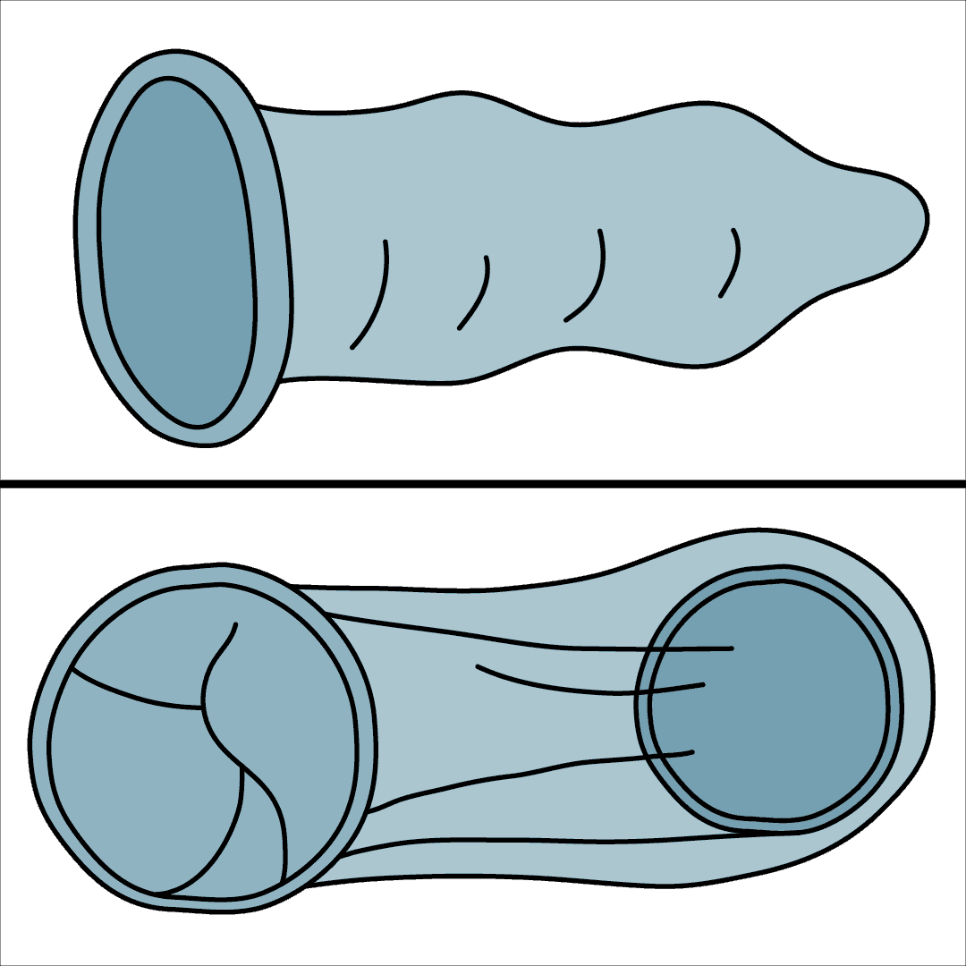 Mhando mbiri dzemakondomu.